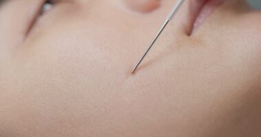 thin needle benefits