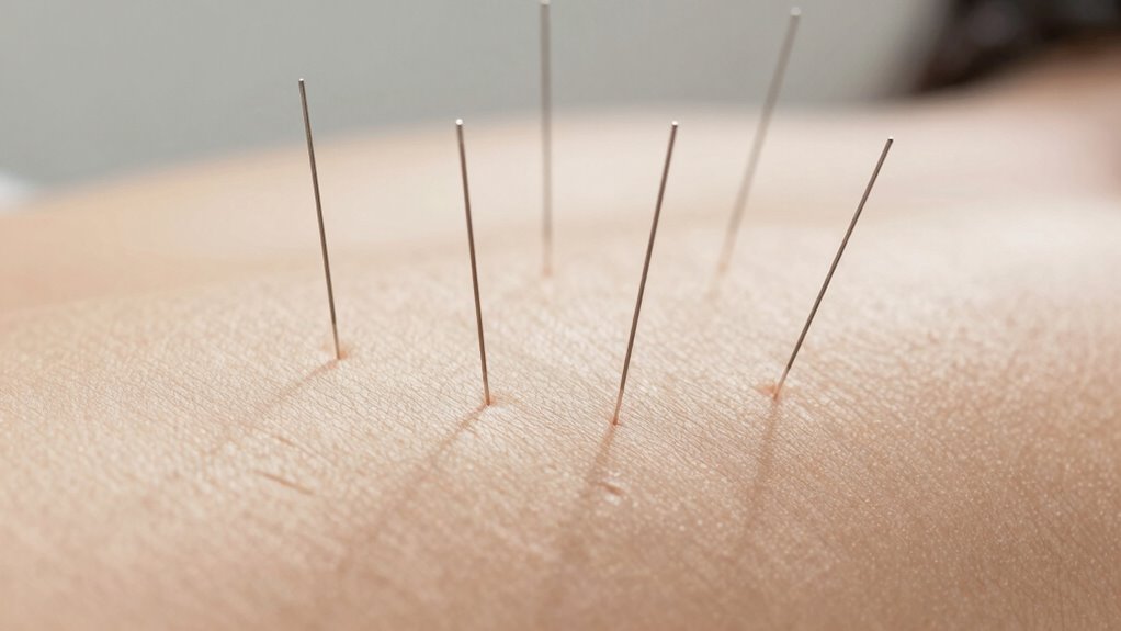 thinner needles enhance comfort