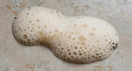 overstretching causes dryness